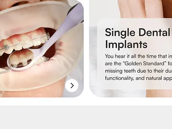 Tratamiento estético dental